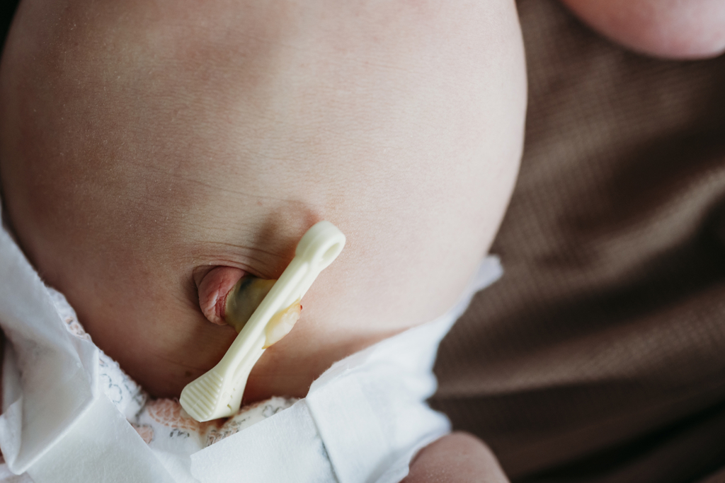 A peg is attached to an umbilical chord of a newborn baby.
